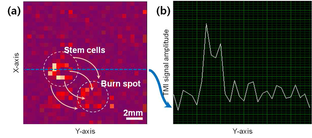 줄기세포 추적 실험. (a) 살아있는 쥐의 피부에서 화상을 입힌 곳으로 이동하는 줄기세포의 TMI 영상. (b) TMI 영상의 THz 신호분포.