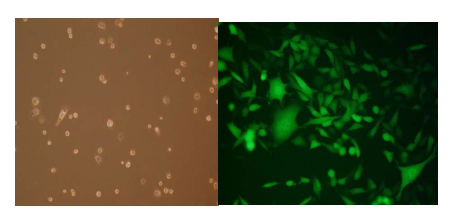 GFP-고발현 MCF7. GFP-vactor transfection 전 (A); (B); stable cell line화 단계의 유방암 세포주