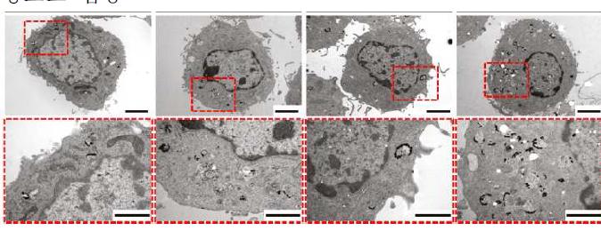 세포내에 축적된 나노 프로브의 투과전자현미경 이미지