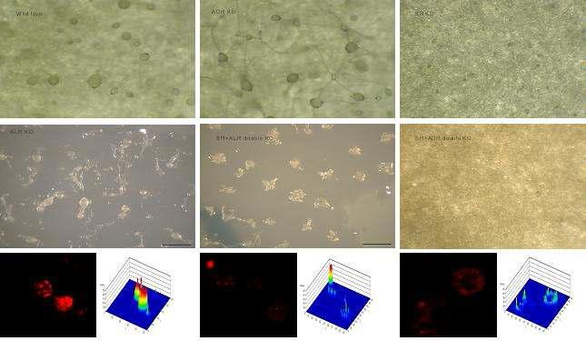 본 연구진에서 Dictyostelium 미토콘드리아 연구모델을 이용하여 심혈관질환과 연관된 특정단백질 후보를 knock-out시켰을 때의 세포분화과정과 미토콘드리아 기능과의 상관관계를 관찰한 실험. 정상(좌상측), 비정상 (나머지). 특정 단백질을 knock-out 시키면 미토콘드리아 기능 (적색 형광)이 현저히 저하됨.