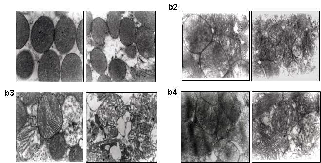 Morphology analysis of cardiomyocytes and mitochondria. wild-type (a1, b1), CAT-/-(a2, b2), GPx1-/- (a3, b3) and GPx1-/-CAT-/- (a4, b4) groups.