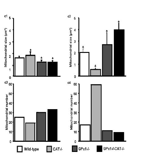 Mitochondrial size and number. Normal condition (c1, c3) and I/R (c2, c4).