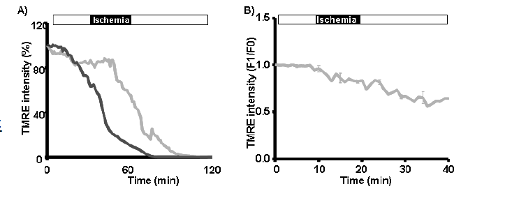 Mitochondrial membrane potential of cardiomyocytes. Wild-type, CAT-/-, GPx1-/-, and GPx1-/-CAT-/-groups with 120 min (A) and 40 min (B) experimental protocols. The different decreased levels of TMRE within the same period were showed (added more, with FCCP).