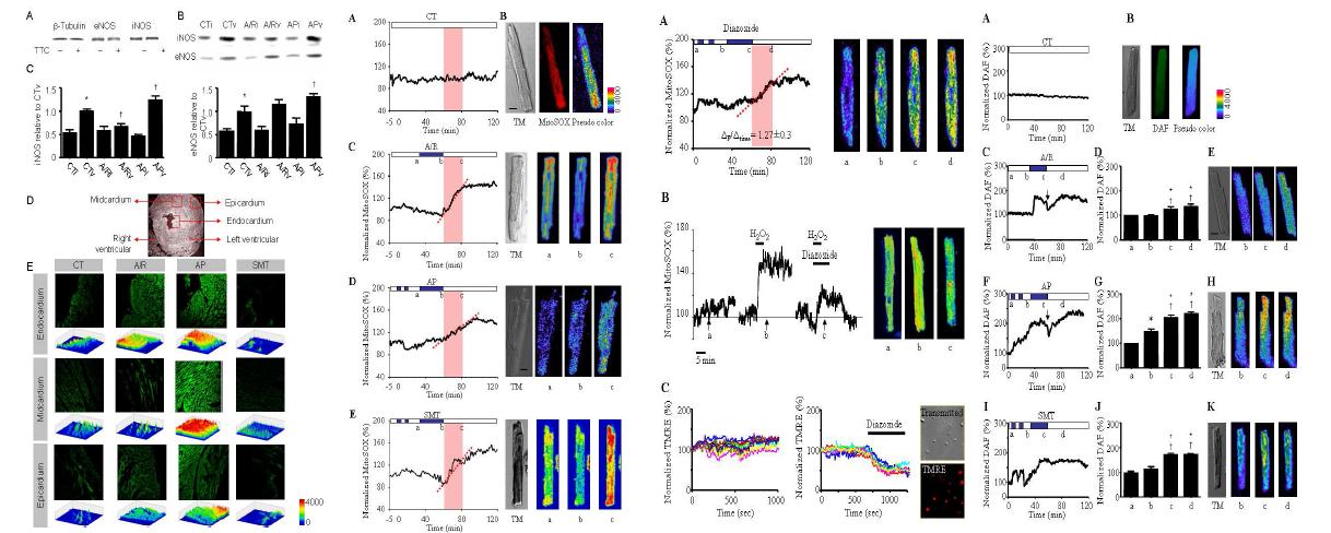 Regional changes in NO synthase expression (1st panel). Dynamic changes in mitochondrial superoxide levels (2nd & 3rd panels) and NO (4th panel).