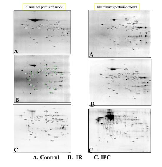 Con, IPC, IR 처리후 재관류 초기 (70분) 와 말기 (180분) 의 단백질체 비교 연구 결과