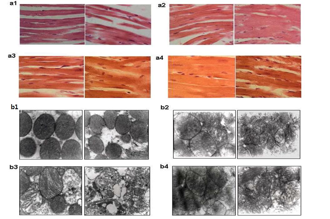 Morphology analysis of cardiomyocytes and mitochondria. wild-type (a1, b1), CAT-/-(a2, b2), GPx1-/- (a3, b3) and GPx1-/-CAT-/- (a4, b4) groups.