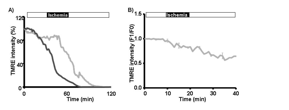 Mitochondrial membrane potential of cardiomyocytes. Wild-type, CAT-/-, GPx1-/-, and GPx1-/-CAT-/-groups with 120 min (A) and 40 min (B) experimental protocols. The different decreased levels of TMRE within the same period were showed (added more, with FCCP).