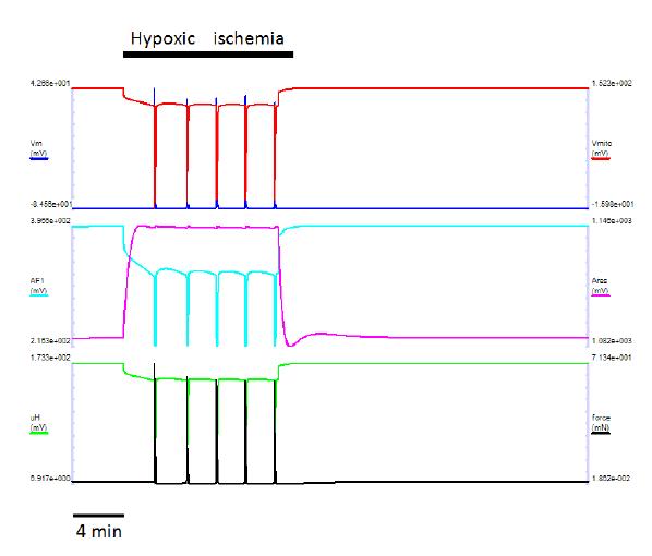 심한 정도의 hypoxic ischemia에 의한 각종 전압의 변화