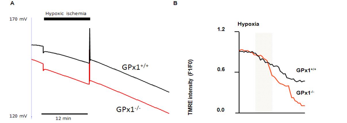 GPx+/+과 GPx1-/- 쥐의 hypoxia/reperfusion에 의한 미토콘드리아 막전압의 변화: (A) 모델링에 의한 결과 (B) 실험 결과