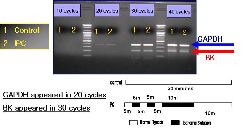 허혈성 전처치 그룹에서의 BKCa 채널 후보유전자의 mRNA 과발현을 관찰한 RT-PCR 사진