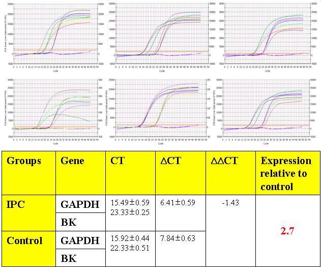 허혈성 전처치 그룹에서의 BKCa 채널 후보유전자의 mRNA 과발현을 관찰한 real time-PCR 결과
