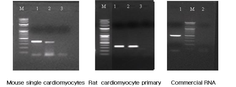 각기 다른 유래의 심근세포 mRNA에서 증폭된 미토콘드리아 BKCa 채널 후보유전자의 mRNA RT-PCR 사진