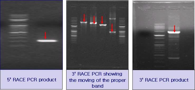 미토콘드리아 BKCa 채널 후보유전자 클로닝을 위한 RACE-PCR 사진 mRNA