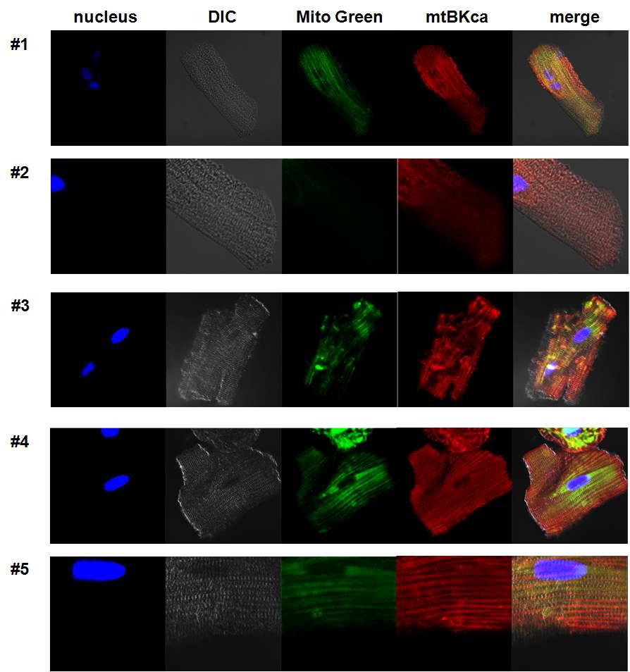 미토콘드리아 특이적 염색제인 mitotracker 와 BKCa 단백질의 colocalization 분석. 두가지 형광 신호가 높은 colocalization 을 가짐