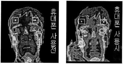 휴대폰 사용 전후의 전신체열 촬영기 촬영결과 비교사진.