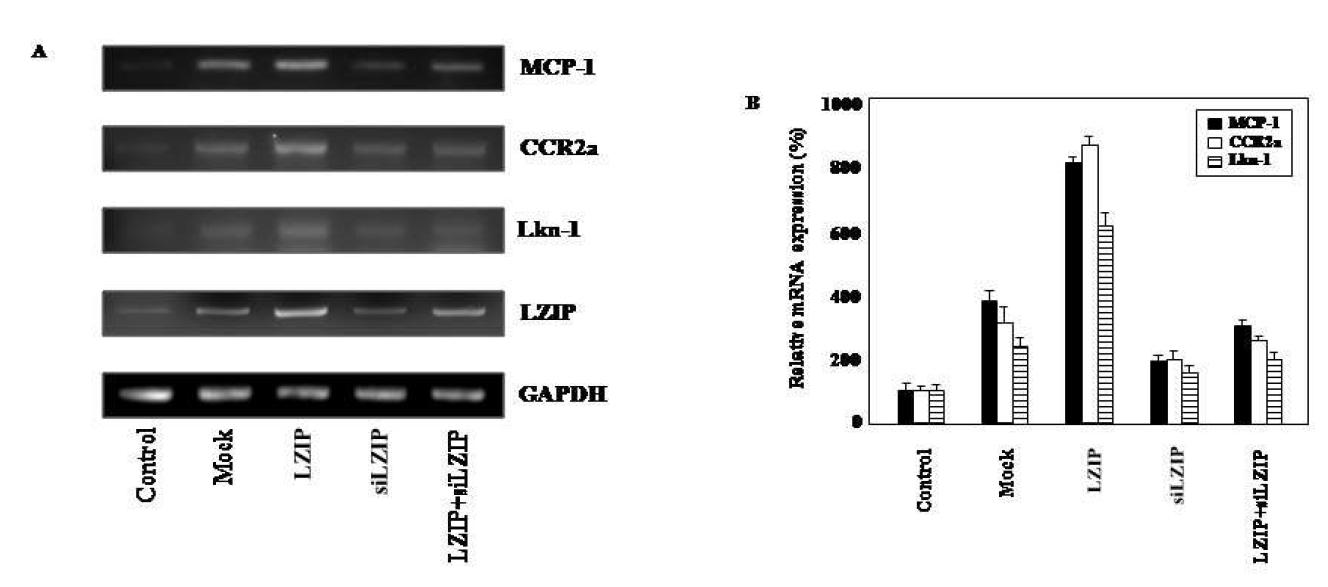 거품세포에서 LZIP에 의해 MCP-1, CCR2의 mRNA 발현이 증가함을 보여주는 결과