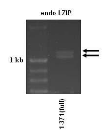 RT-PCR에 의한 LZIP 증폭 시 double band가 관찰됨을 보여주는 결과.