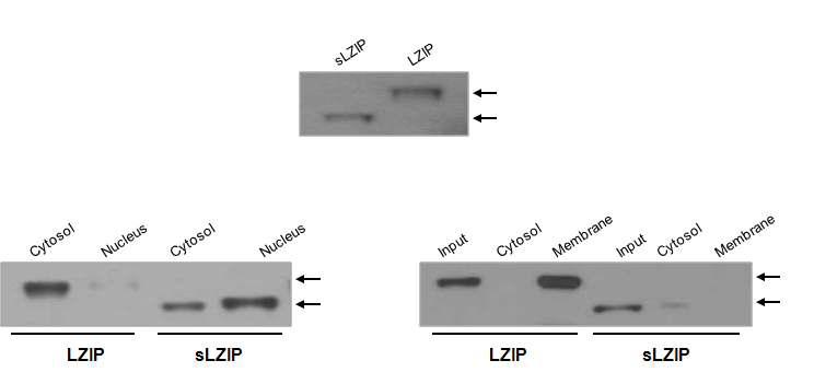 LZIP isoform의 발현 확인 및 세포내 위치를 보여주는 결과.