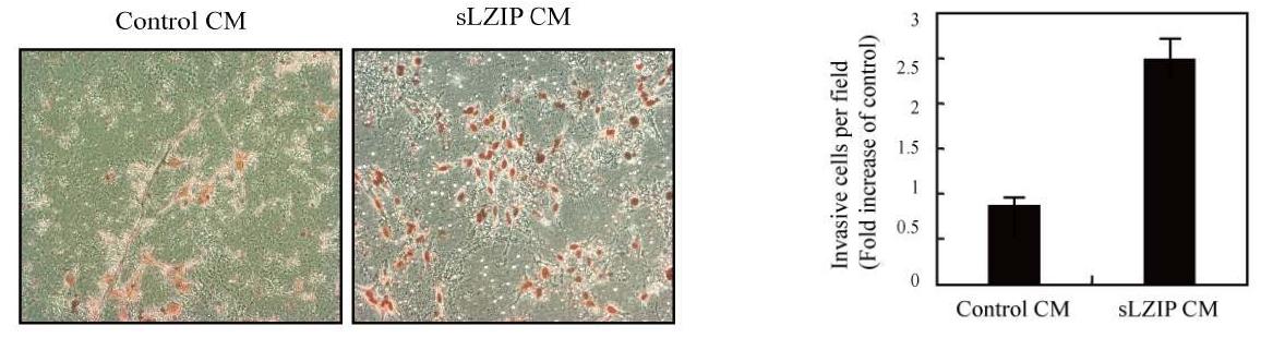 sLZIP을 과발현시킨 conditioned medium에서 키운 세포의 invasion정도가 대비군에 비교해서 증가됨을 확인한 결과