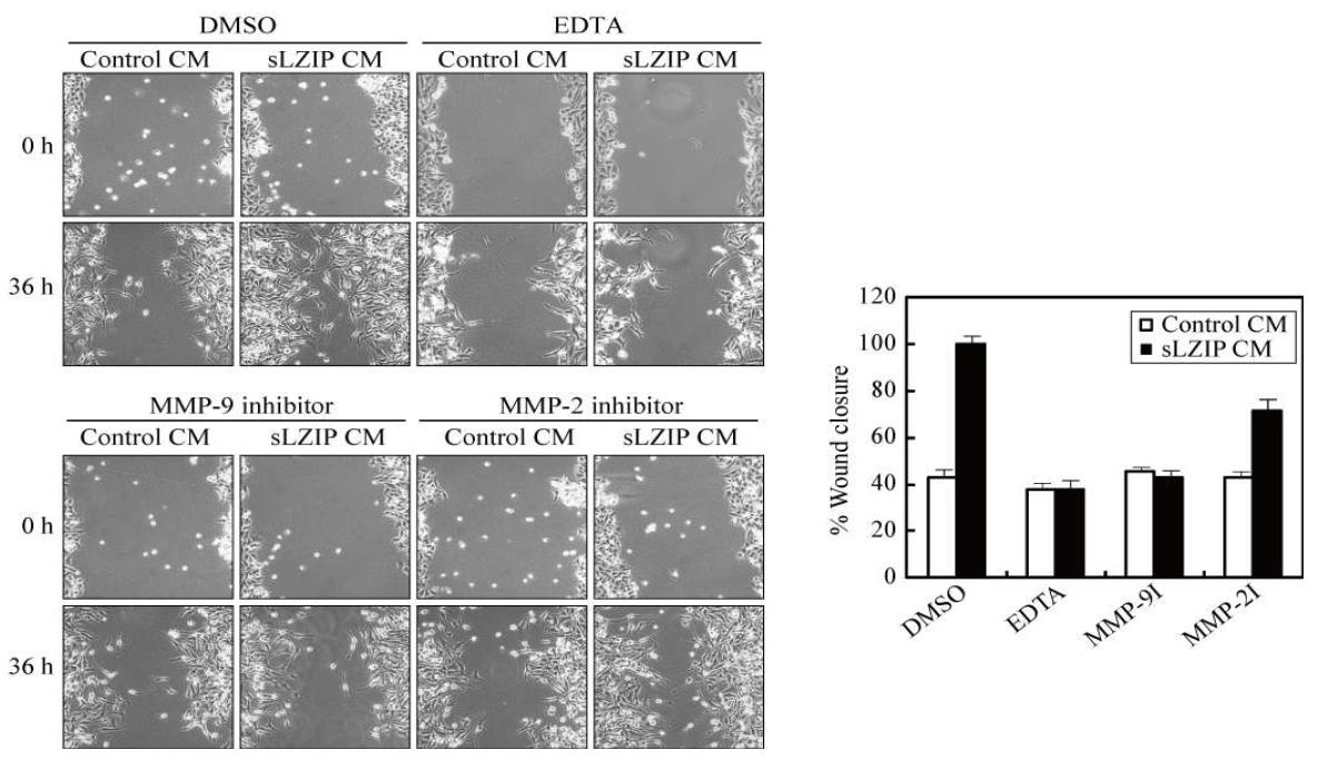 세포외 기질 분해효소 공통 억제제처리 (EDTA)와 MMP-9 억제제 처리시 sLZIP conditioned medium내의 세포 이주정도가 감소함을 보여주는 결과