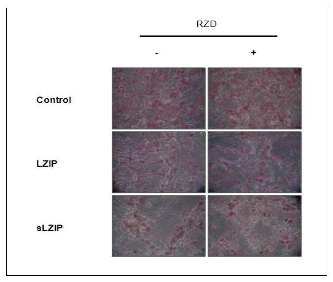 LZIP이 PPAR-γ에 의한 지방세포 분화를 억제함을 나타내는 결과