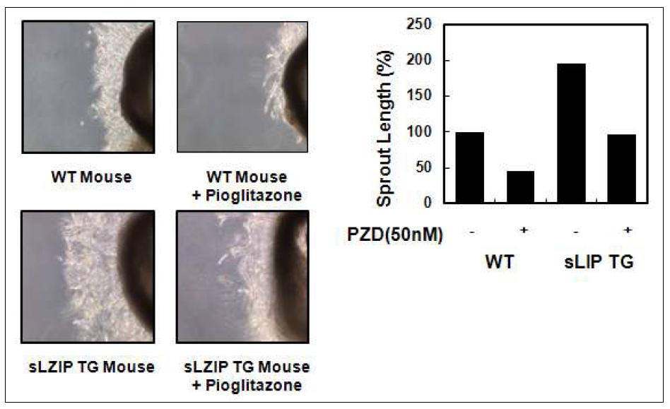 sLZIP 과발현 마우스에서 평활근세포의 이동이 증가됨을 나타내는 결과