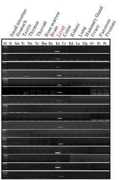 조직 특이성 유전자의 검증 - 간 조직 특이성 유전자의 RT-PCR 확인 결과