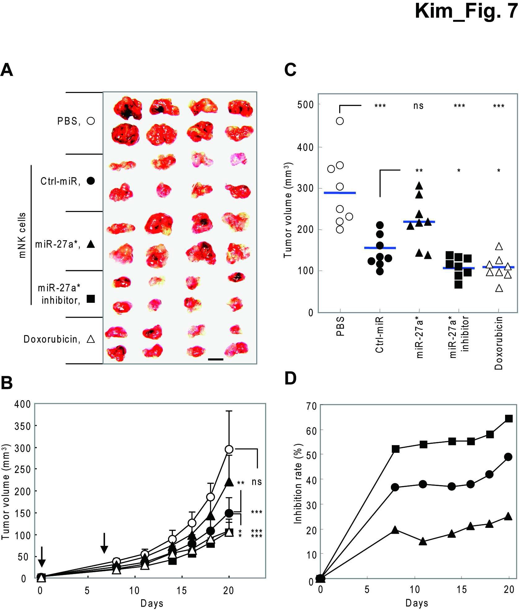 miR-27a*에 의한 NK 세포 살상능의 인간 암 이종 이식 마우스 모델(in vivo)적용