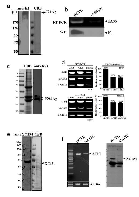 오토항체특이반응 항원단백질의 동정 및 siRNA를 이용한 확인