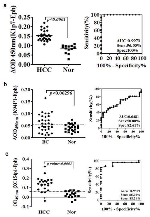 K1, K94및 XC154 항체 특이반응 고리형 에피토프 펩타이드를 이용한 인체 혈청중의 오토항체검출 결과및 암진단에의 활용