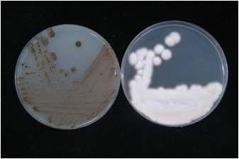 Comparison of the morphological characters between the wild type and mutant strain.