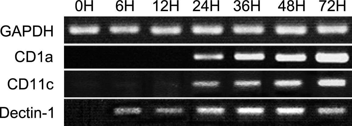 CD1a, CD11c and Dectin-1 expression in muDC.