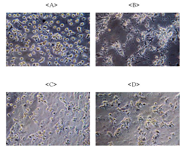 Morphologic changes of muDC by PMA, zymosan and PZYc. Differentiated muDC for 48hr(A), stimulated muDC with PMA(100ng/ml) was attached on the plate, and extend many side branch(B), stimulated muDC with zymosan(100㎍/ml) was containing the suspension condition, and small dark point is zymosan partial(C), stimulated muDC with PZYc was attached on the plate, however, so weakly attached than only PMA stimulated muDC(D).