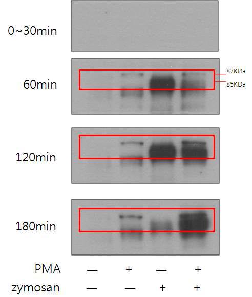 Differences phosphorylation pattern of IKK-subunits (85kDa; α-subunit, 87kDa; β-subunit).