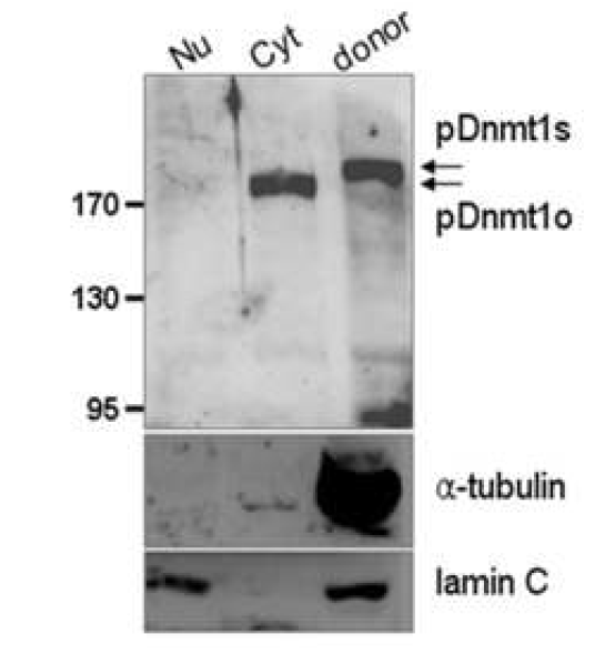 핵치환 복제수정란의 미세조작을 통한 Dnmt1o 단백 질의 세포질 위치 확인.