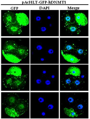 Baculovirus 유래 GFP-Dnmt1s 재조합단백질의 2-세포기 생쥐 수정란 미세주입.