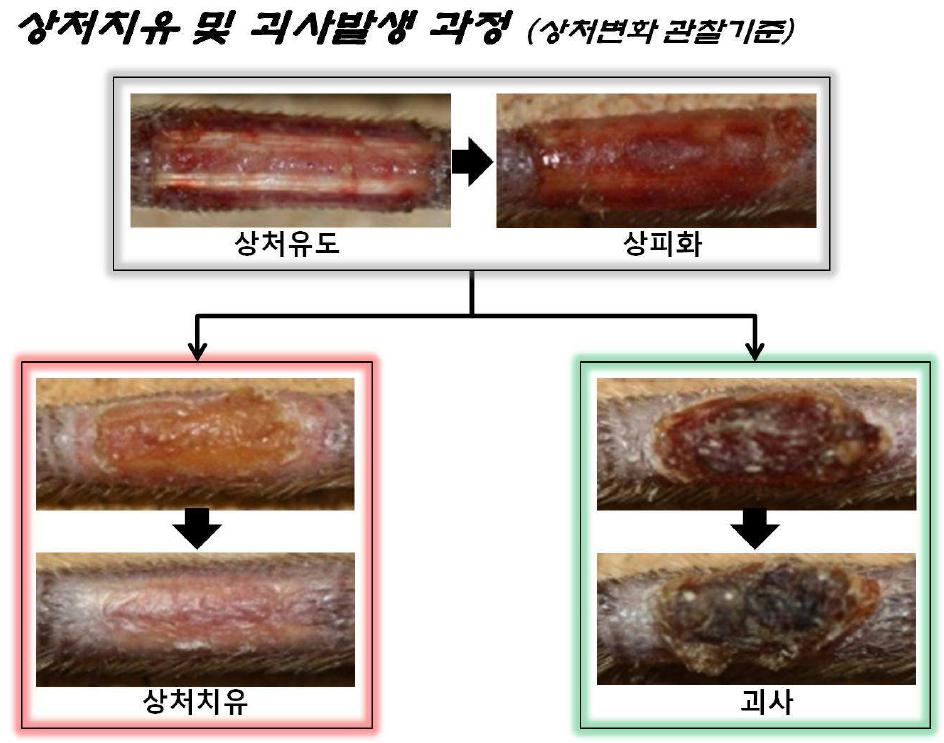 당뇨병에 의한 족부괴사 발생 과정