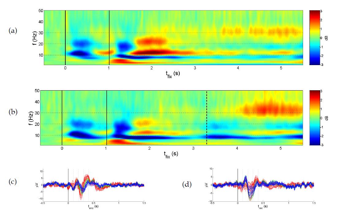 시공간 작업 기억과제 수행 중 측정된 뇌파의 ERSP(event-related spectral perturbation). tfix=0 : fixation cross 자극 제시 시점. tfix=1 : encoding 자극 제시 시점.