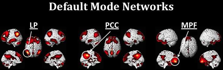 기본신경망으로 잘 알려진 3개의 영역(PCC: Posterior Cingulate Cortex, LP: Lateral Pareital, MPF: Medial Pre-Frontal)을 seed로 한 connectivity mapping 결과