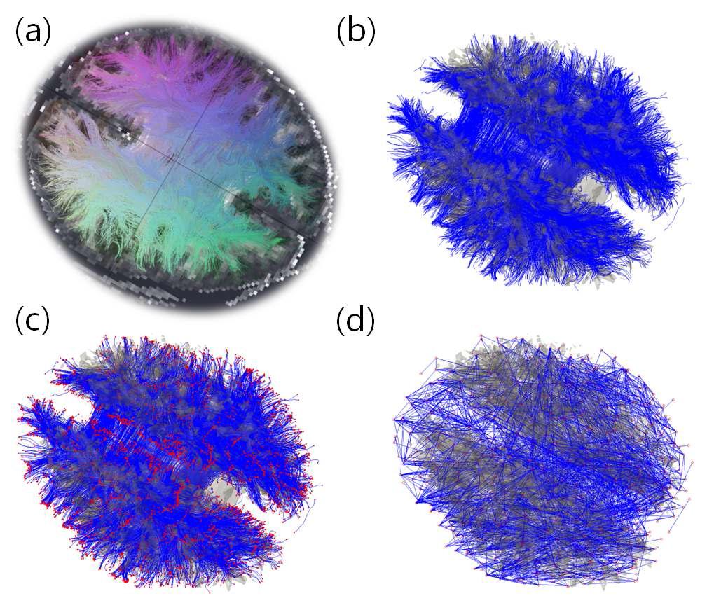 확산텐서 이미지로부터 신경다발을 추적하고 뇌 구조 네트워크 얻는 과정.