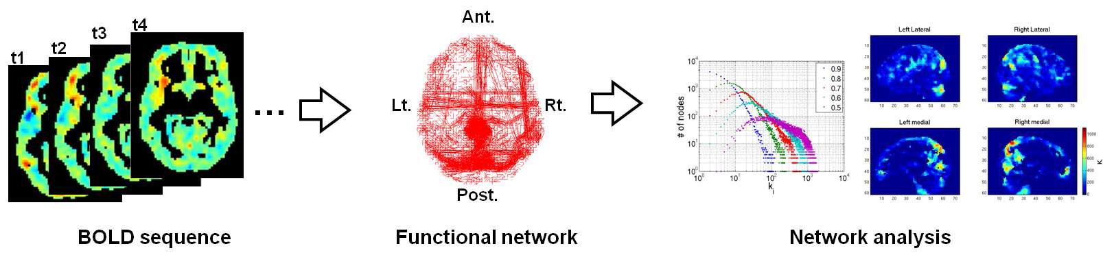 fMRI BOLD 신호로부터 네트워크 추출 및 분석 모식도