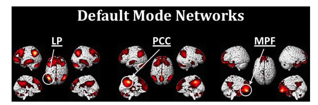 기본신경망으로 잘 알려진 3개의 영역(PCC: Posterior Cingulate Cortex, LP: Lateral Parietal, MPF: Medial Pre-Frontal)을 seed로 한 connectivity mapping 결과