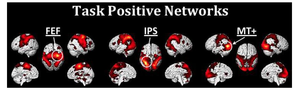 Task positive network으로 잘 알려진 3개의 영역(FEF: Frontal Eye Field, IPS: Inferior Parietal Sulcus, MT+: Middle Temporal)을 seed로 한 connectivity mapping 결과