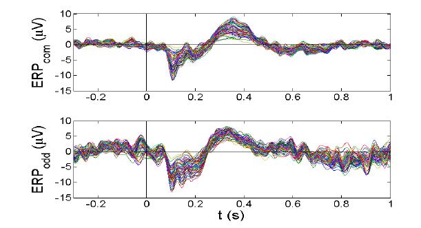 청각 oddball 유발전위 패턴. 상단: 표 준자극에 대한 반응 패턴, 하단: 이탈자극에 대 한 반응 패턴