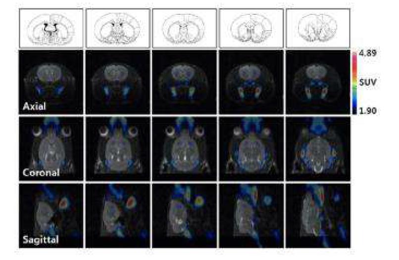 PET/MRI 융합 기술을 통한 기능적, 해부적 정보 제공