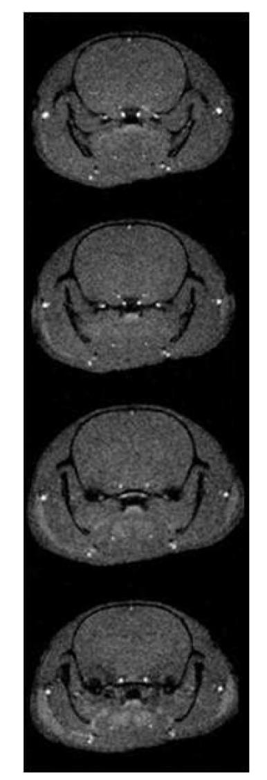 Rat Brain DCE 영상 (9.4T MRI)