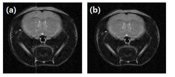 RF 노이즈 제거를 위한 보간법 적 용 결과. (a) 적용 전 (b) 적용 후