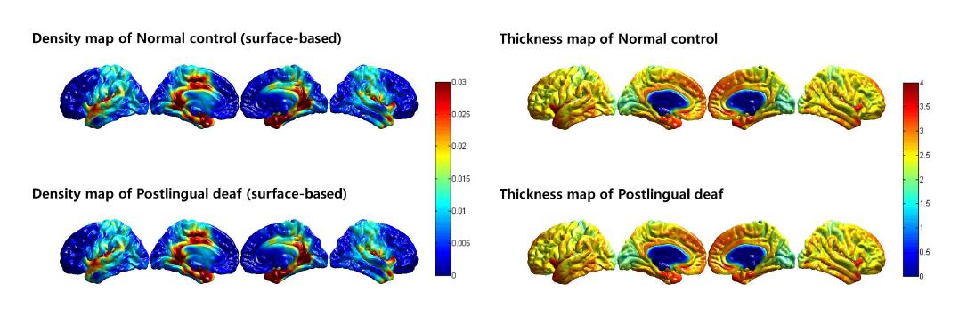 Surface based representation of gray matter density and cortical thickness. The mean of density and thickness of each group were represented to the figure