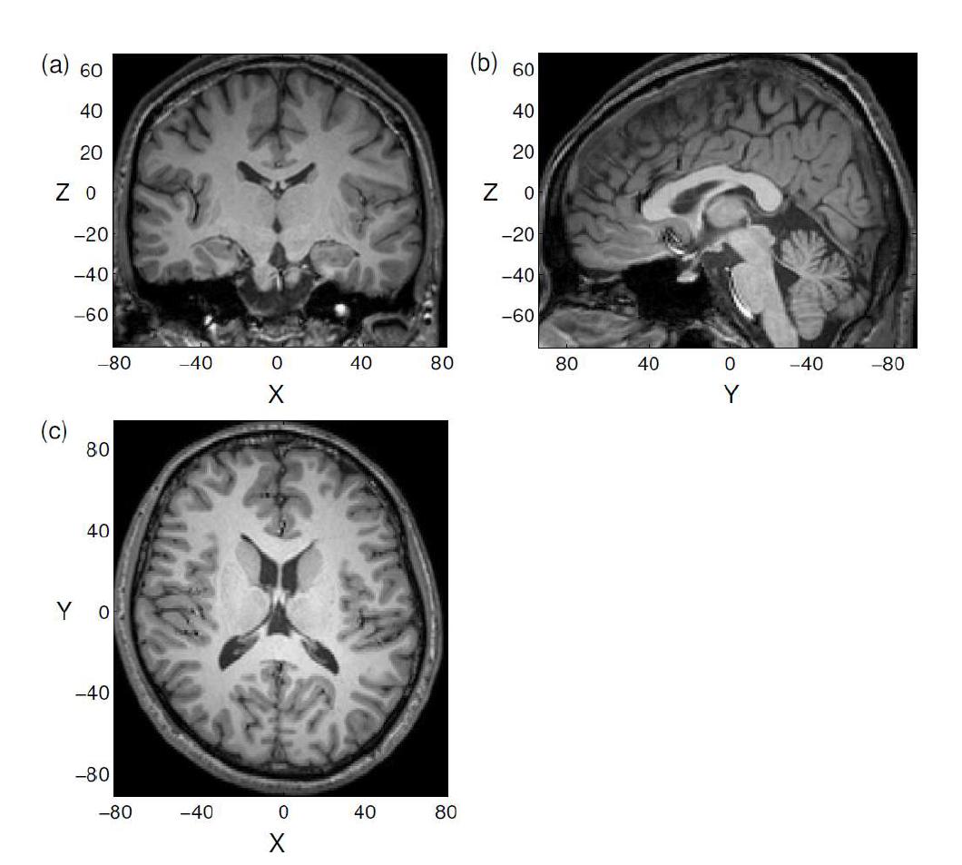 고해상도 뇌 구조영상(T1 weighted image). mm스케일. 원점 (0,0,0)을 지나는 단면 (a) 관상면상(coronal view) (b) 시상면상(sagittal view) (c) 축면상(axial view)