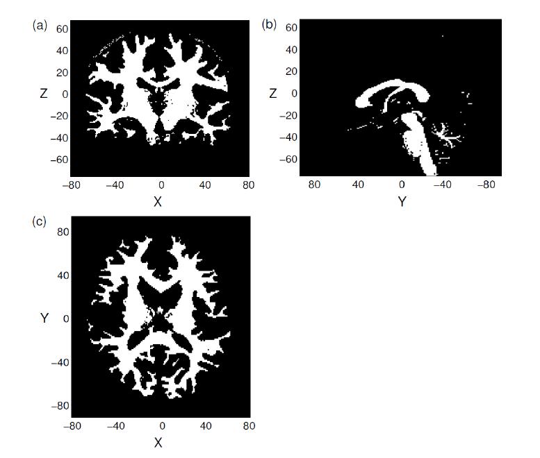 백질(white matter). 복셀의 밝기가 밝을수록 백질일 확률이 크다.